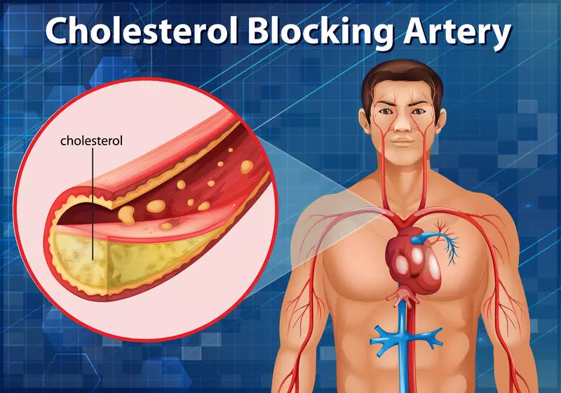 Cholesterol Unveiled: The Hidden Role of Stress and Gut Health in Your Heart's Story