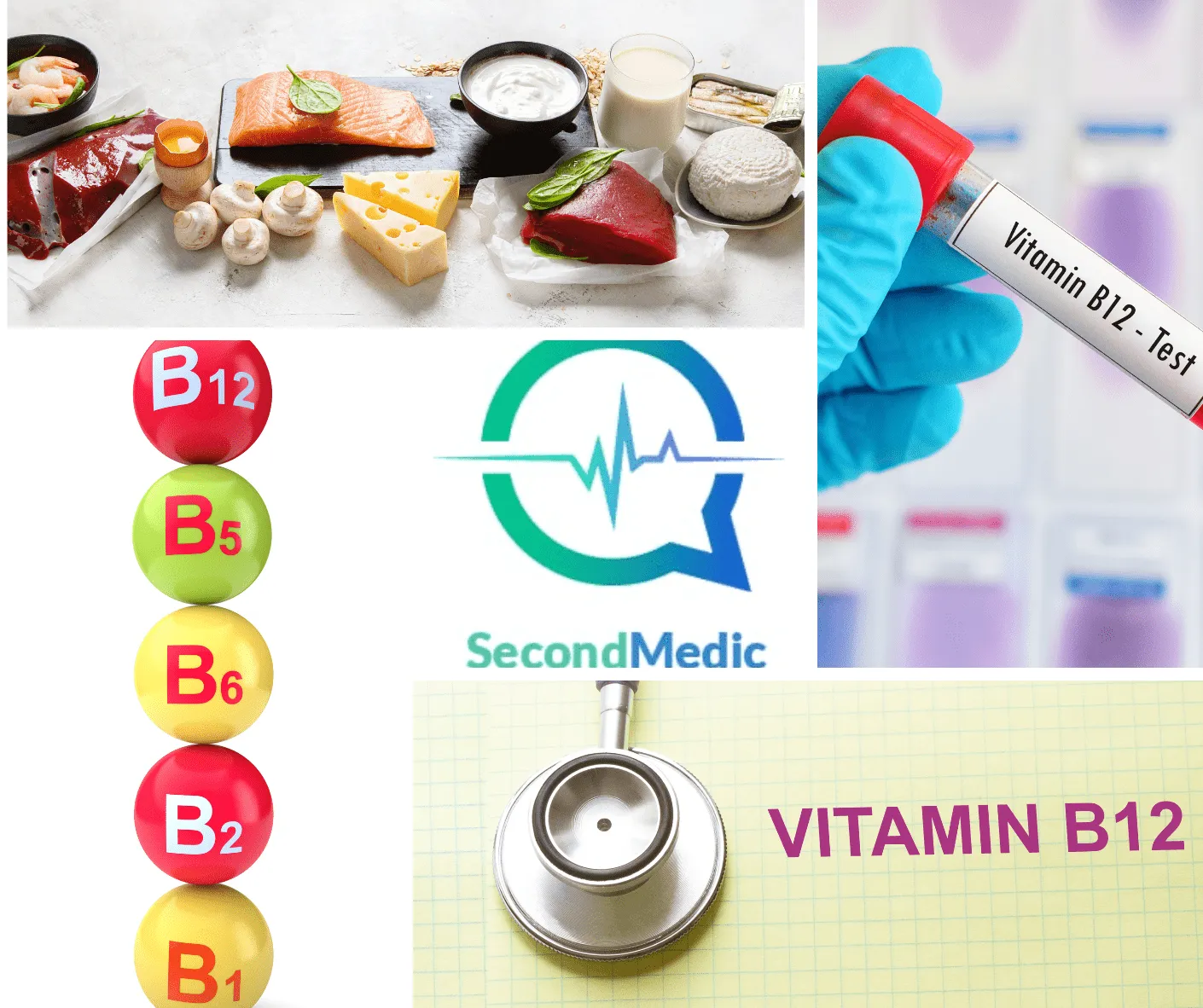 Vitamin B12 deficiency Symptoms, Causes, Diagnosis & treatment.
