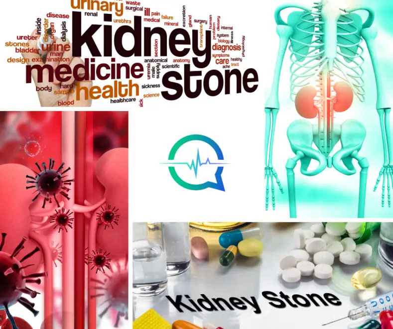 Kidney Stones Treatment, Symptoms, Causes, Prevention ?