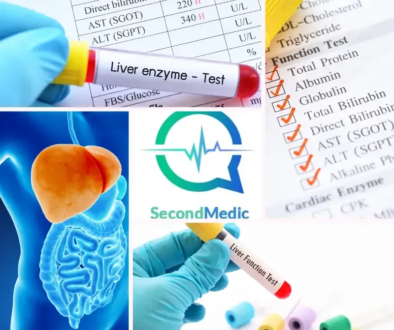 Understanding liver function test