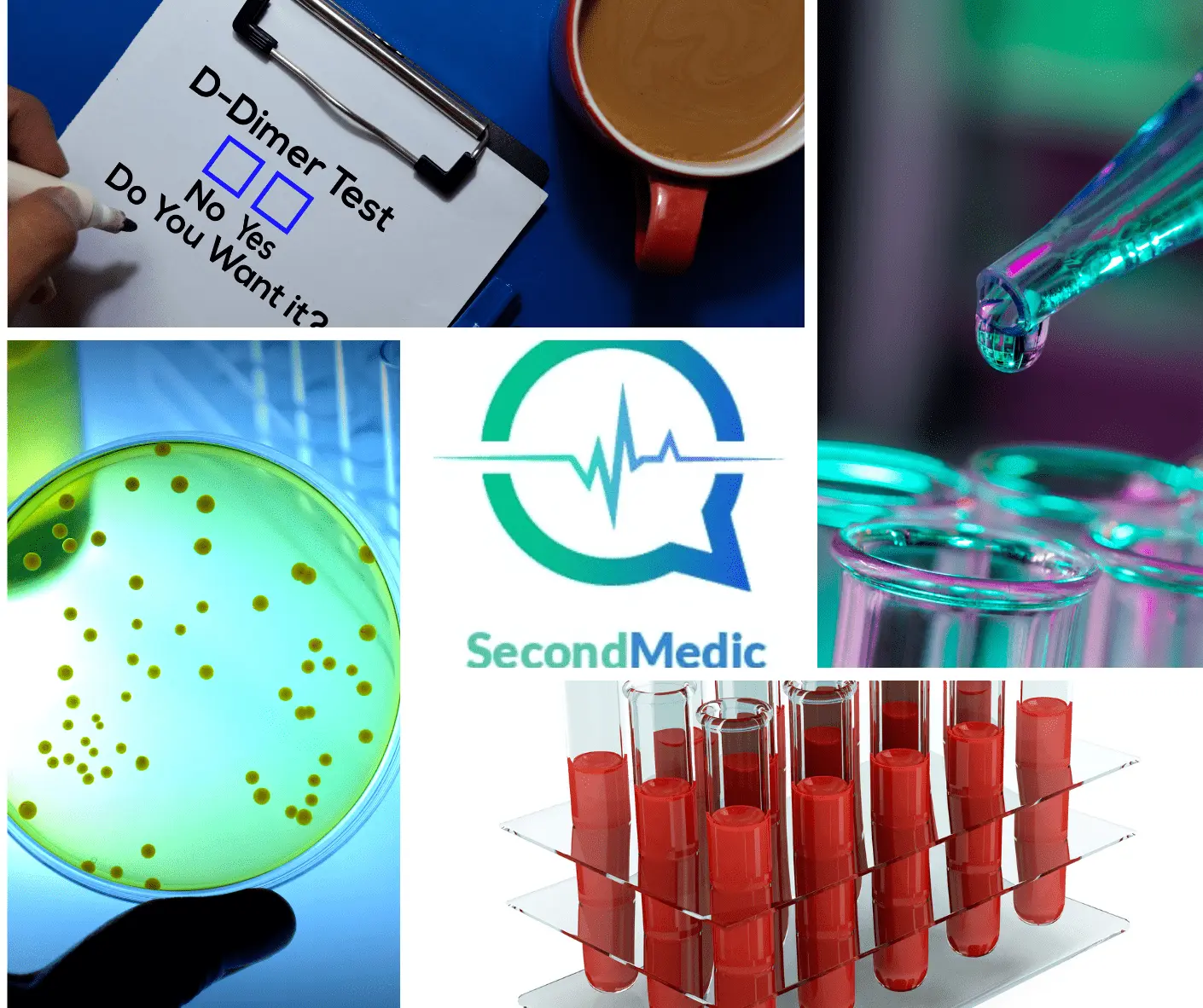 What Is the D-Dimer Test?