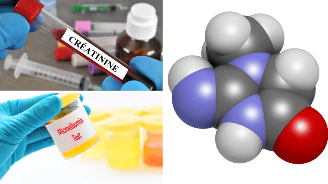 Understanding Microalbumin Creatinine Ratio: A Comprehensive Guide to Kidney Health