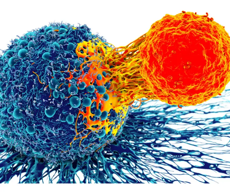 What is the 4th stage of lung cancer?