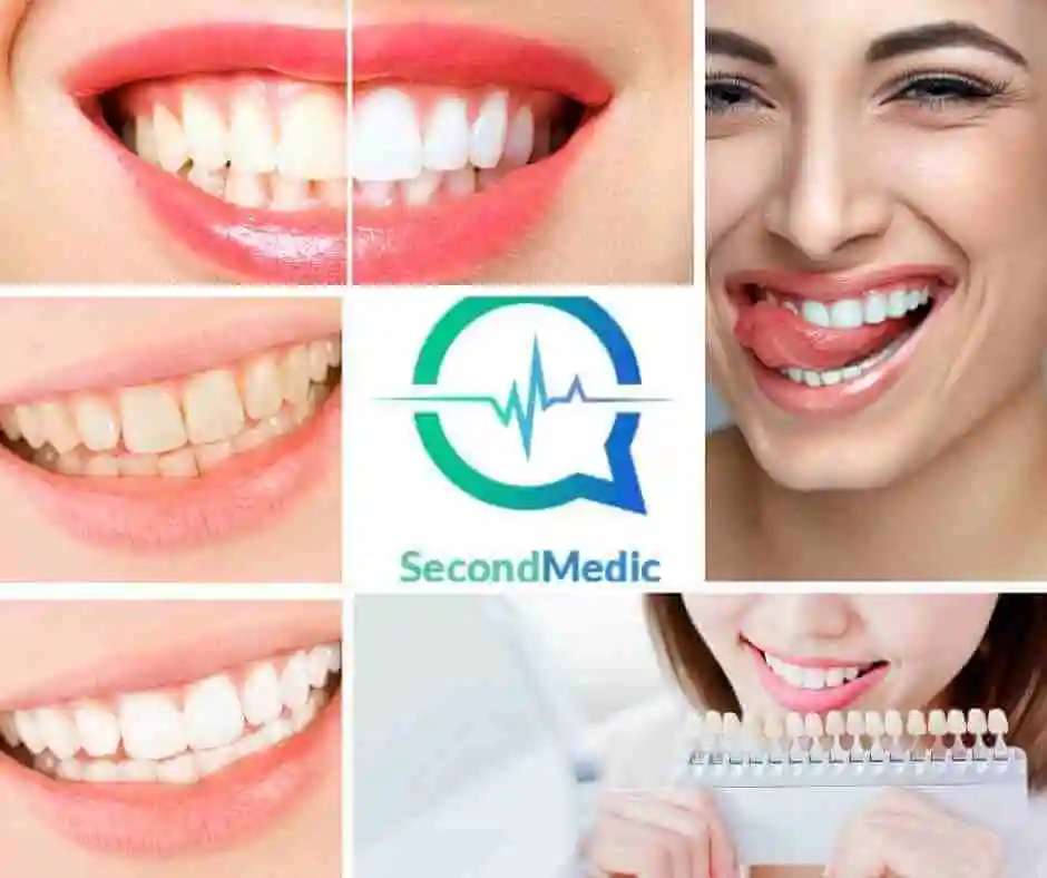 Renowned Dentists providing Expert medical Opinion on How can I naturally whiten my teeth?