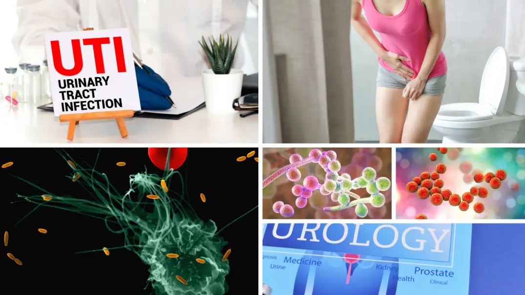 Urinary tract infection: Causes, symptoms, and prevention