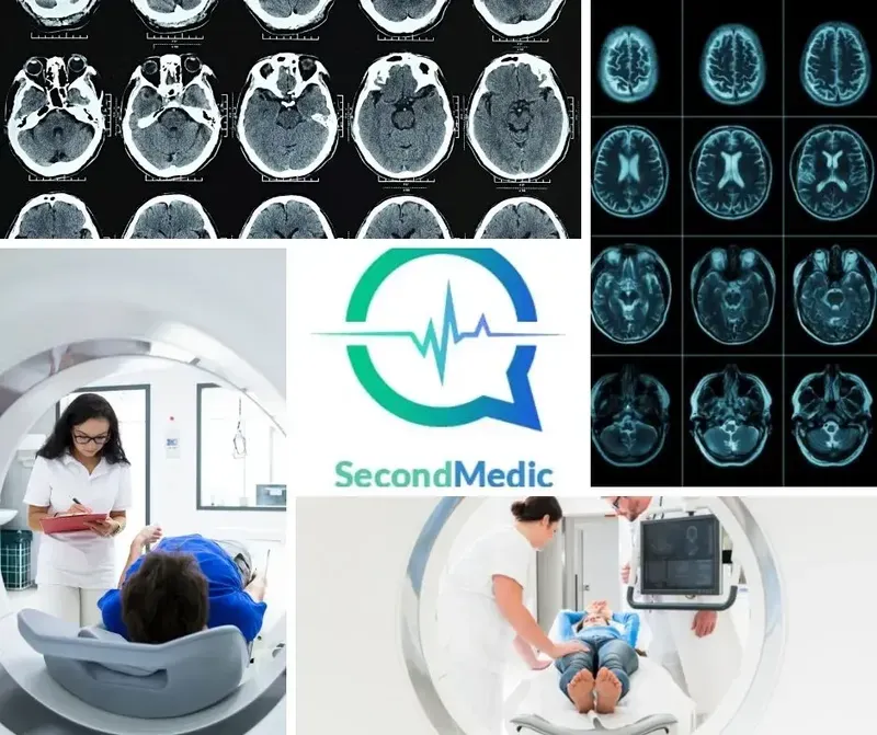 What Is a CT Scan?