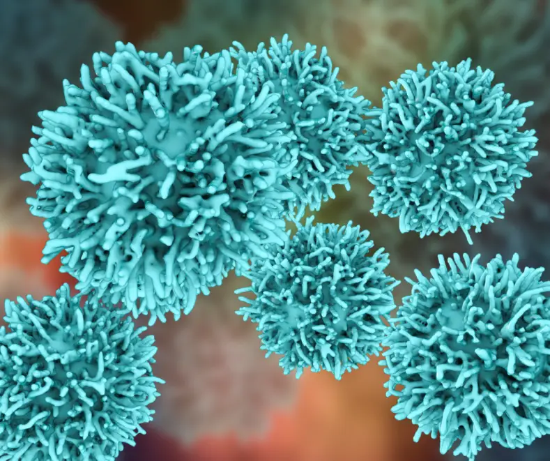 How do people develop stage 4 cancer 