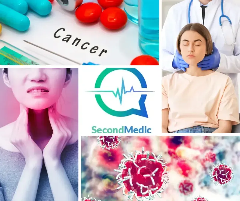 Throat cancer – symptoms, causes, diagnosis & treatment.