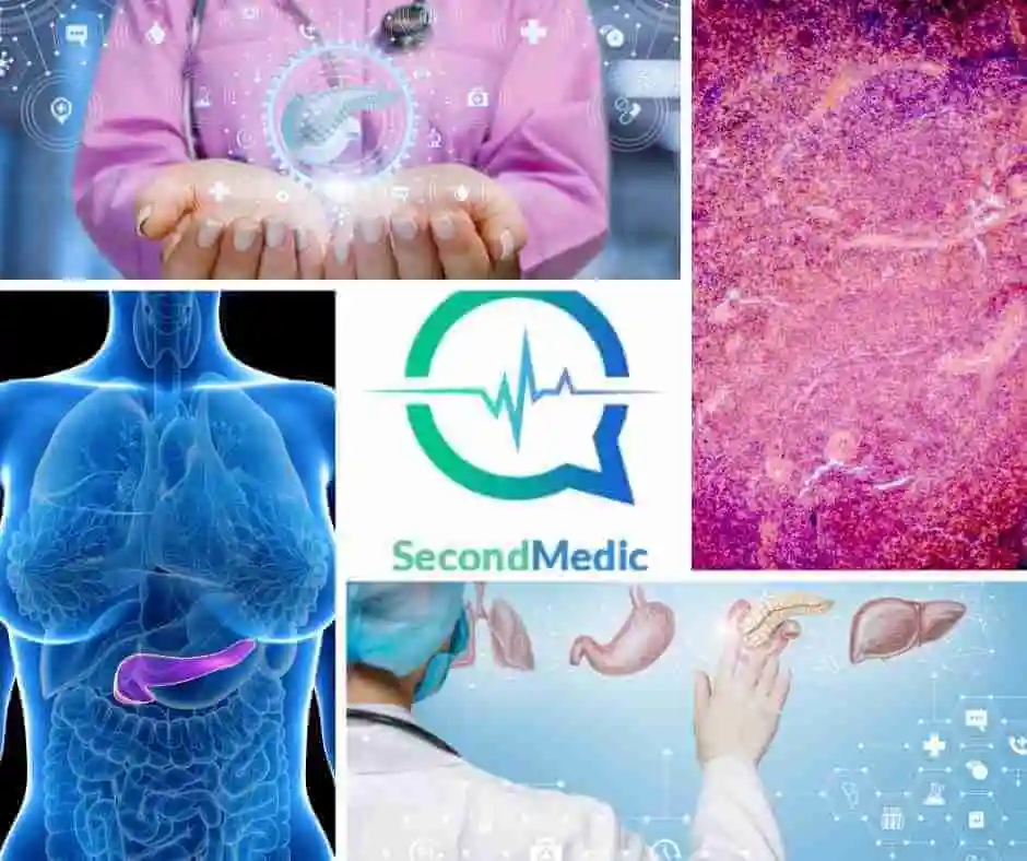 Medical Second Opinion on Reversing damage to the pancreas