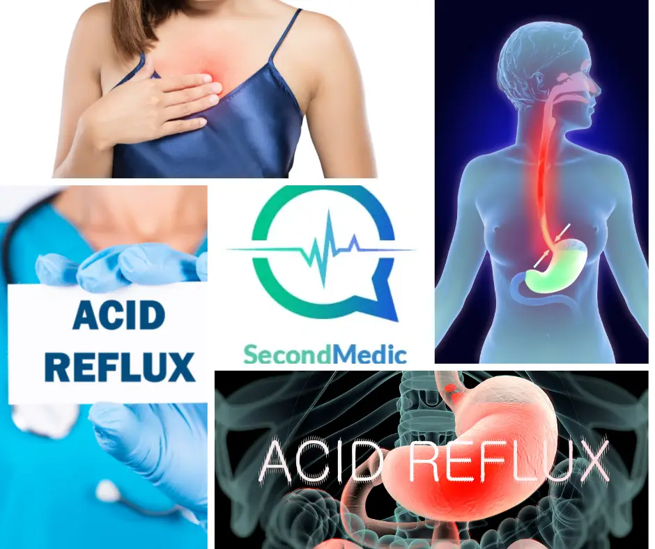 Acid Reflux Disease Symptoms, Causes, Tests, and Treatments