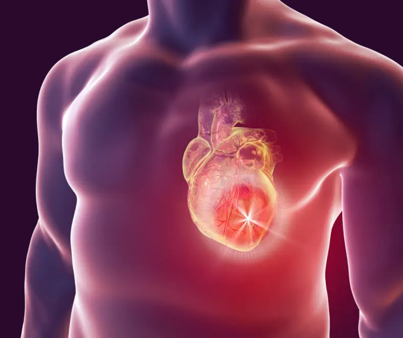 Preventing Stroke: The Power of Healthy Choices