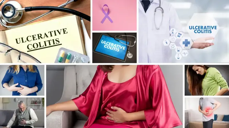 ulcerative colitis - cause, symptoms, diagnosis & treatment.