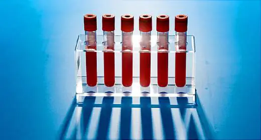 Early Cancer Detection: One Blood Test