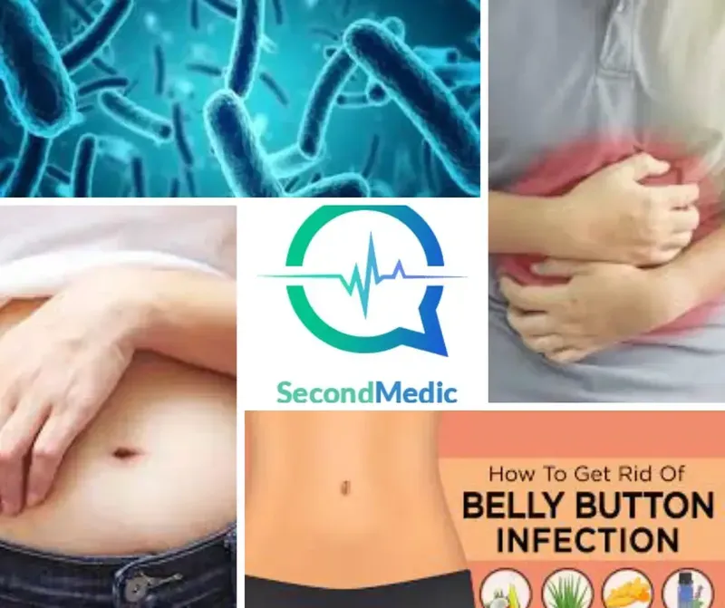 Belly button infection cause, prevention, symptoms, diagnosis & treatment! 