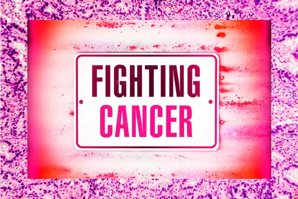 Adenocarcinoma Cancers: Symptoms, Causes, Diagnosis