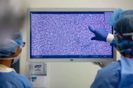 Brain Tumor Treatment through AI-Powered Precision