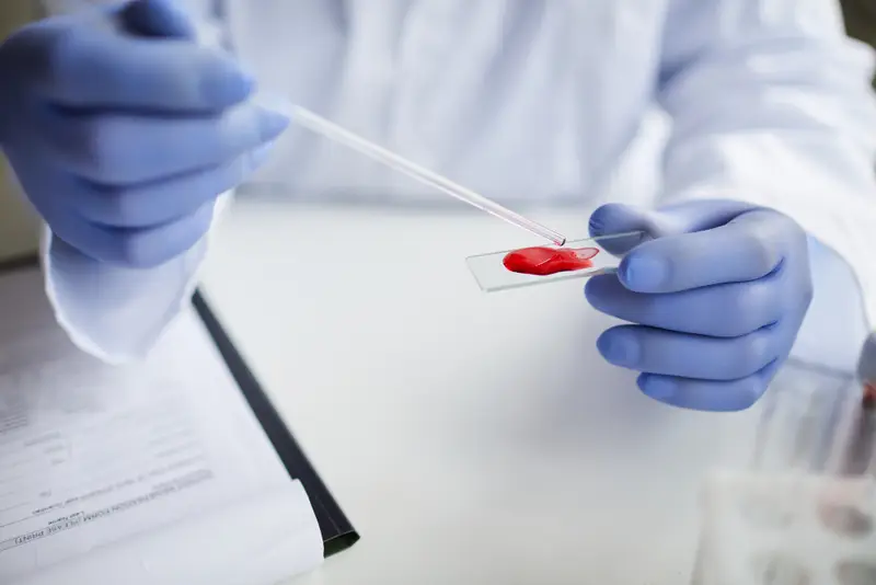 Understanding the Importance of Complete Blood Count (CBC) Test in Health Checkups