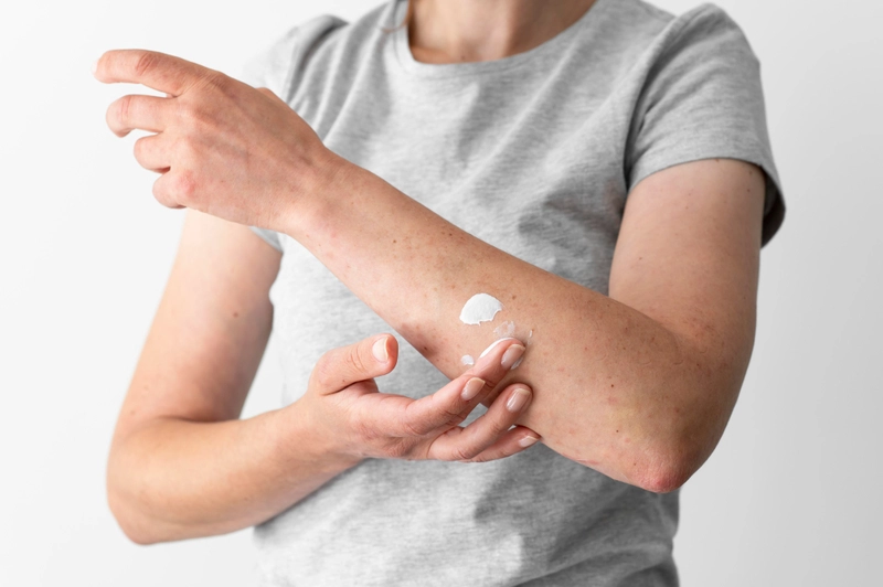 Rise of Fungal Skin Infections During Monsoon: Causes, Symptoms & Prevention