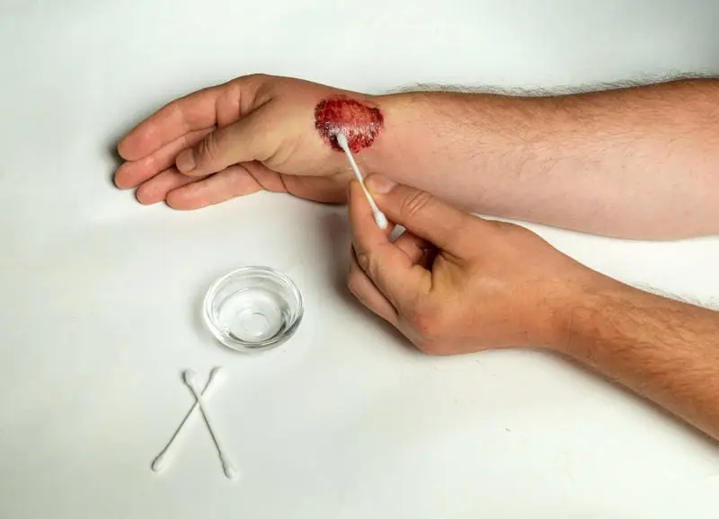 How to Apply Betadine on Cuts and Wounds Safely: Complete Guide
