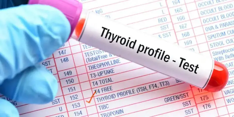 Thyroid Testing and Weight Management: The Connection