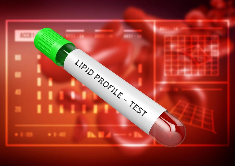 Lipid Profile Test – Normal Range and Risks