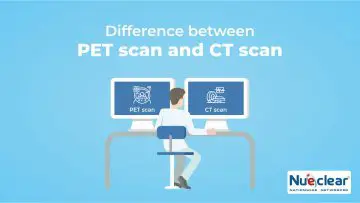 PET Scan vs CT Scan