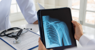 Digital X-Ray