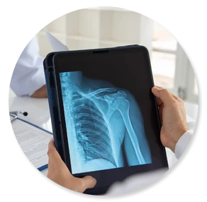 X-Ray
