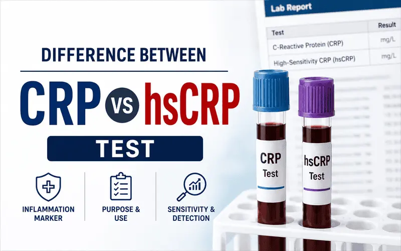 Difference Between CRP and hsCRP Test