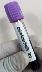 AMINO ACID PROFILE (35)