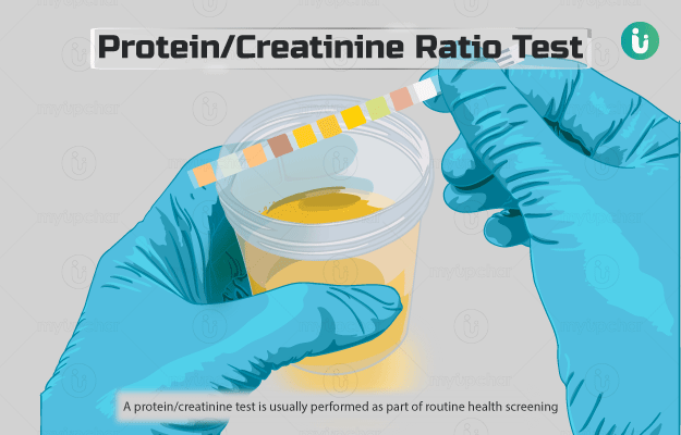 URINE PROTEIN CREATININE RATIO