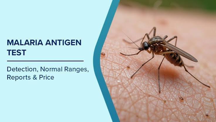 MALARIAL ANTIGEN