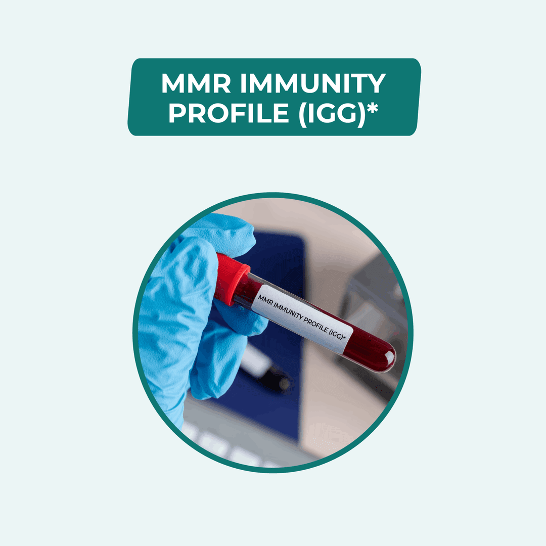 MMR IMMUNITY PROFILE IGG IGM ANTIBODIES