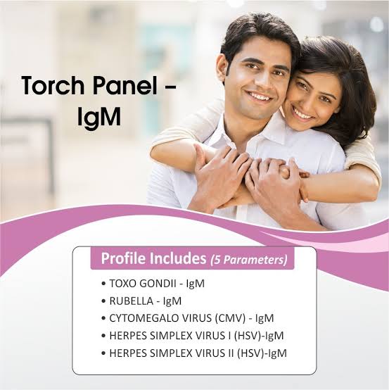 TORCH PANEL IGM