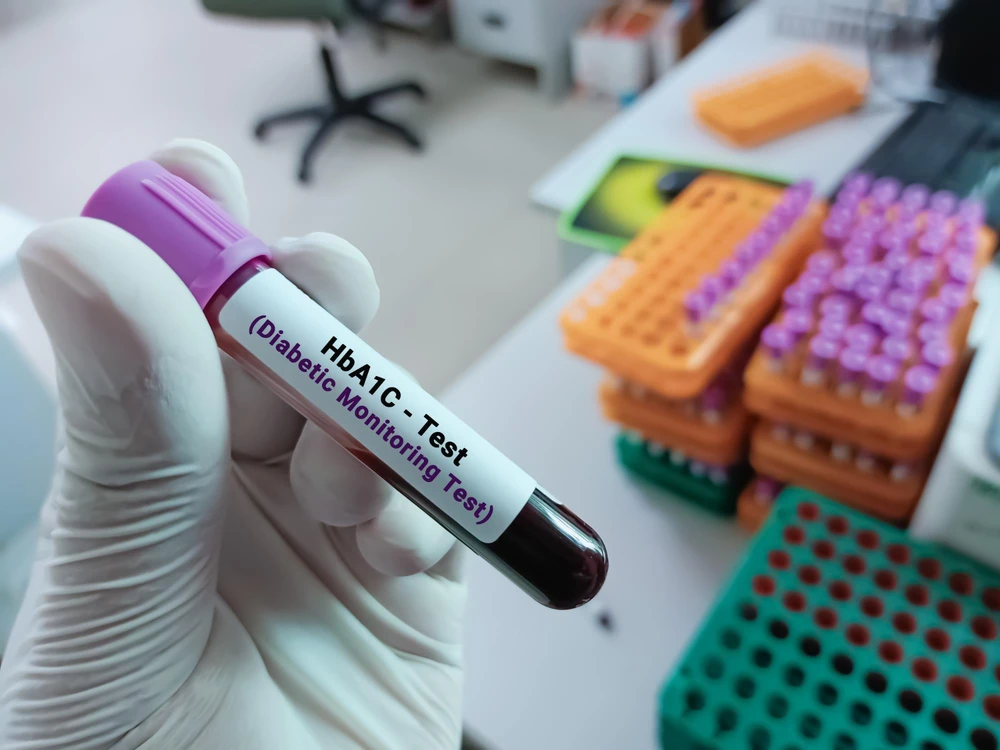HbA1c
